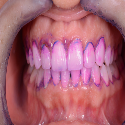 Biofilm Discloser 242